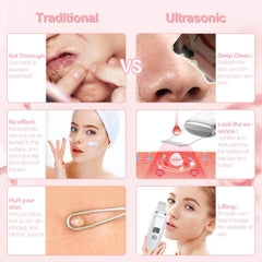 Blackhead removal tool for home use